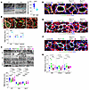 Pkd1 deletion induces cilia-dependent BM remodeling.