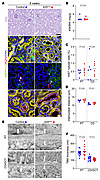 Kif3a inactivation alone does not lead to tubule distension.