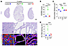 Comparison between neonatal cilia and Pkd1 loss reveals distinct modes of t