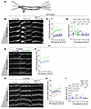 Pkd1 deletion alters tubule biomechanics.