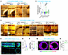 ECM mechanics modulate Pkd1–/– tubule-on-chip dilation in vitro.