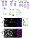 Decrease in TBM stiffness promotes cyst formation in vivo.