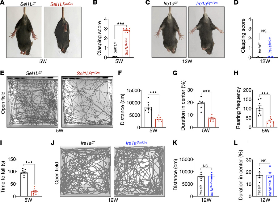 JCI - Neuronal SEL1L-HRD1 ER-associated degradation is essential for ...