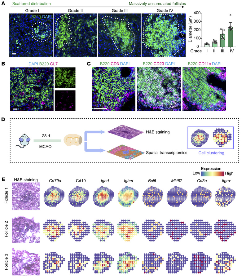 Spatial and cellular characteristics of massively accumulated B cells in...