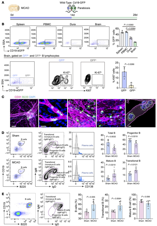 Origin of B lymphocytes in ischemic stroke and comparison between lesion...