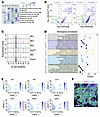IFN-related signaling pathways and the relationships with B lymphocyte biol