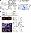 IFN-related signaling pathways drive the detrimental effects of B lymphocyt