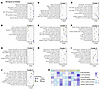 Validation of IFN-related signaling pathways in human PBMC samples of ische