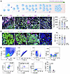 Characteristics of the massively accumulating B lymphocytes in the ischemic