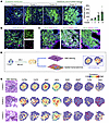 Spatial and cellular characteristics of massively accumulated B cells in th