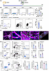 Origin of B lymphocytes in ischemic stroke and comparison between lesion-re