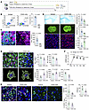 B lymphocytes depletion with anti-CD20 mAb reduces ischemic stroke injury a