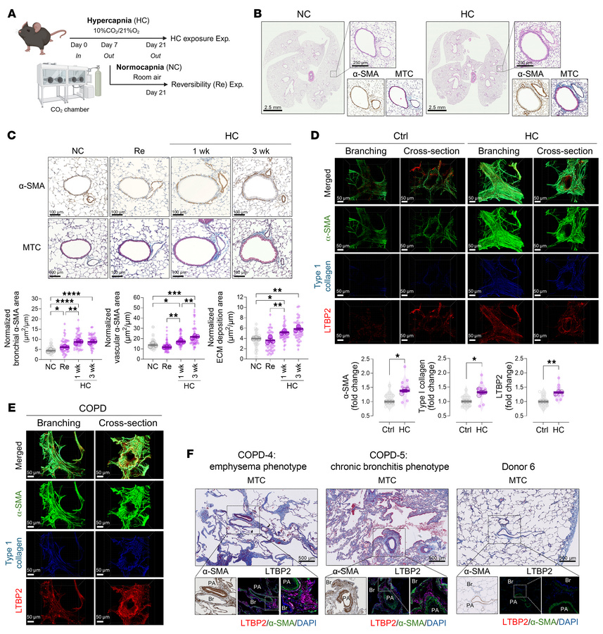 Hypercapnia induces airway and vascular remodeling that reflects COPD hi...