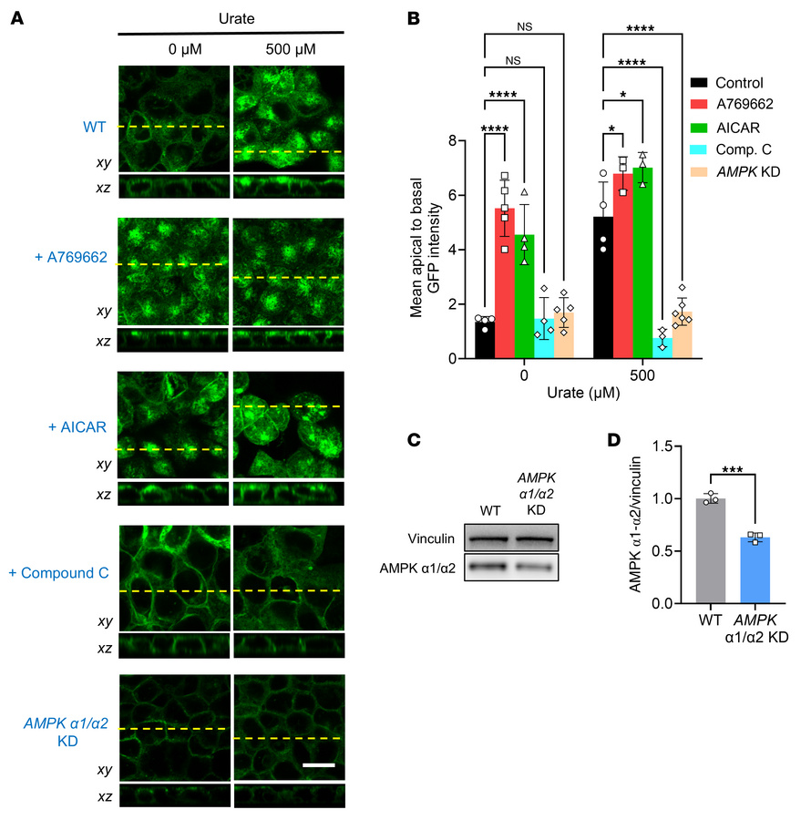 Urate-induced apical accumulation of AQP2 requires AMPK activation.
(A) ...