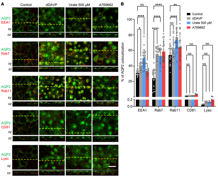 Urate-induced AQP2 trafficking requires AMPK activation and endosomal tr...