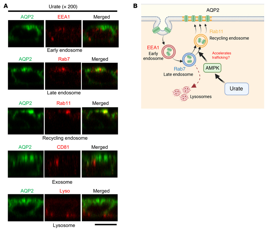 Proposed mechanism of urate-induced AQP2 trafficking.
(A) Original magni...