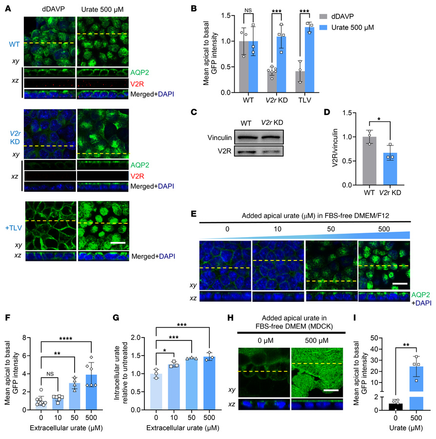 Urate induces concentration-dependent, V2R-independent apical traffickin...
