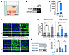 Urate induces apical trafficking of AQP2 in polarized collecting duct cells