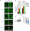 Urate-induced apical accumulation of AQP2 requires AMPK activation.
