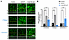 Urate-induced apical accumulation of AQP2 requires endosomal trafficking.