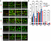 Urate-induced AQP2 trafficking requires AMPK activation and endosomal traff