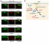 Proposed mechanism of urate-induced AQP2 trafficking.