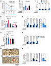 Probenecid attenuates tolvaptan-induced polyuria in mice.