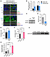 Urate-induced AQP2 trafficking is potentiated by inhibition of ABCG2-mediat
