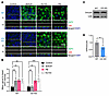Pharmacological inhibition of ABCG2 induces apical AQP2 accumulation in a V
