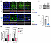 Pharmacological inhibition of ABCG2 induces apical AQP2 accumulation in a G