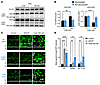 Urate-induced AQP2 translocation is independent of Ser256 phosphorylation.