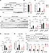 Hepatic NFE2L1 deficiency stabilizes INSIG1 protein.