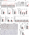 NFE2L1 ameliorates liver injury and inflammation in MASH.