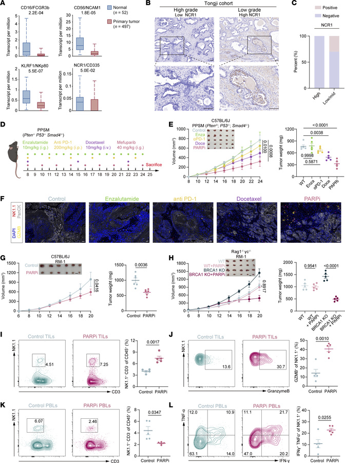 PARPi revitalize NK cells in the PCa microenvironment.
(A) Expression of...