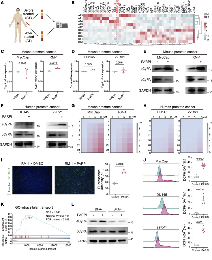 PARPi stimulate PCa cells to release CypA.
(A) Paired peripheral blood s...