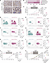 CypA overexpression in tumors boosts NK cell chemotaxis and cytotoxicity.