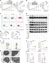 FPR1 mediates AKT and ERK1/2 phosphorylation to enhance NK cell efficacy.