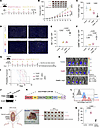 The combination of PARPi with adoptive NK therapy inhibits CRPC growth and