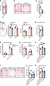 Mettl3K480R/+ mice exhibit levodopa-responsive parkinsonism.