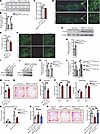 Mettl3 depletion in DA neurons recapitulates neurodegenerative and levodopa
