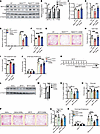 SAMe replenishment mitigates parkinsonism in mouse models.