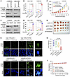 Genetic knockdown of TOP2A expression in sotorasib-resistant NSCLC cell lin
