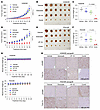 KRAS G12C mutant tumors with acquired resistance to KRAS G12C inhibitors ar
