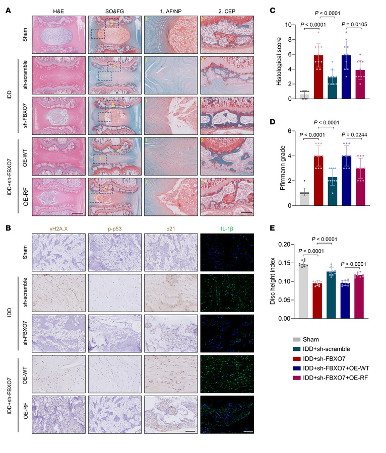 FBXO7 methylation deficiency promotes NPC senescence and IVDD progressio...