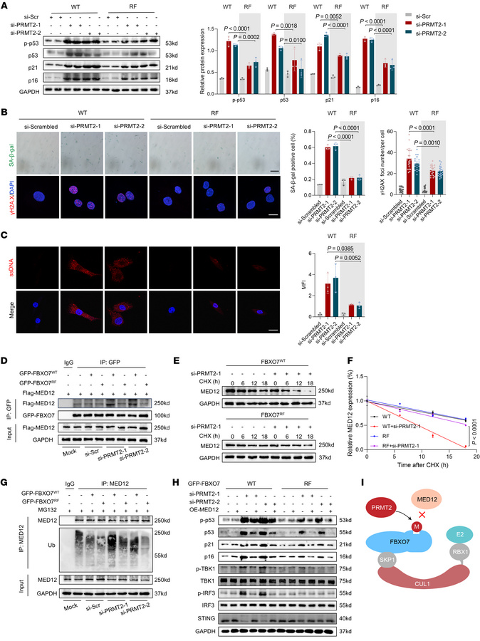 Loss of PRMT2 promotes FBXO7/MED12/R-loop axis–dependent NPC senescence....