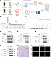 FBXO7 methylation is downregulated in IVDD.