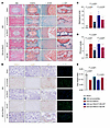 FBXO7 methylation deficiency promotes NPC senescence and IVDD progression.