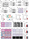 Loss of PRMT2-mediated FBXO7 R504 methylation promoted NPC senescence and I
