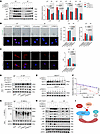 Loss of PRMT2 promotes FBXO7/MED12/R-loop axis–dependent NPC senescence.