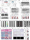 EV-based MED12-overexpressing plasmid cargo alleviated NPC senescence and I